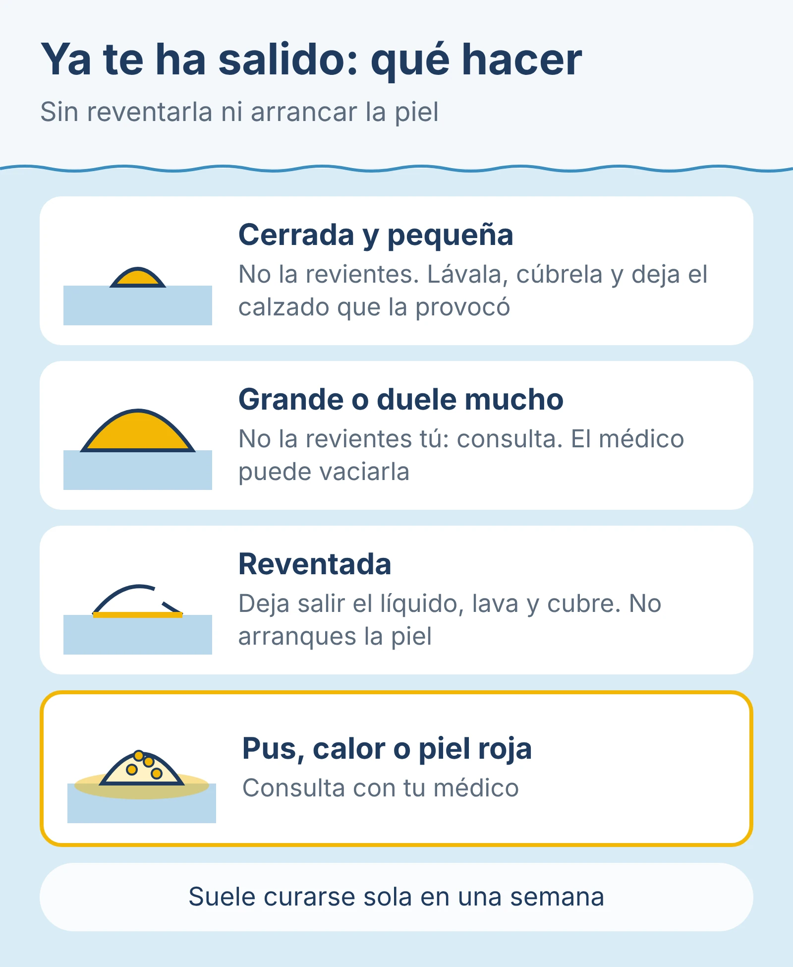 Diagrama: qué hacer con una ampolla según esté cerrada y pequeña, sea grande o duela mucho, esté reventada o tenga señales de infección.